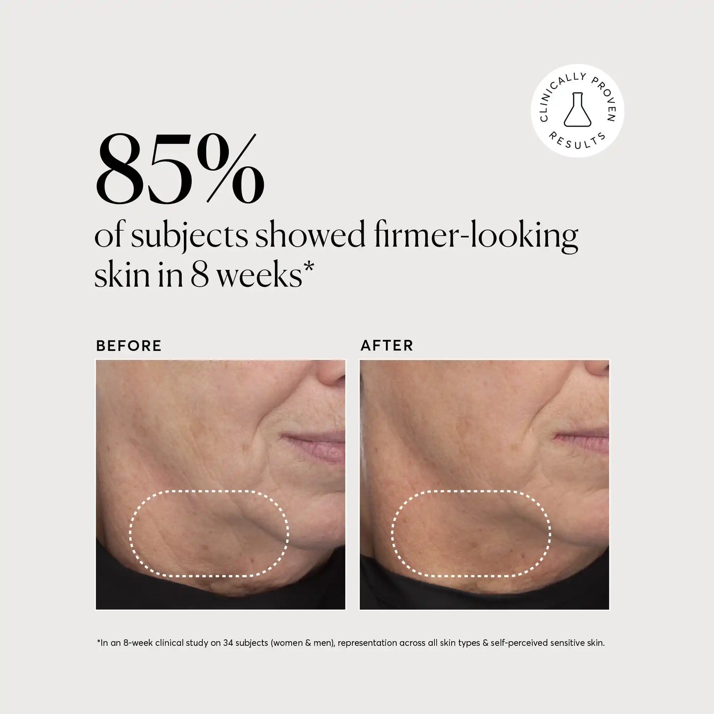retinol-complex-serum-r6 NATR-10034-Alt-Images-Retinol-Complex-Serum-04.webp
